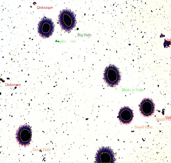 计算机精子分析系统软件精子DNA碎片测试